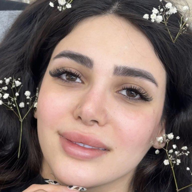 ترمیم مژه با شادی